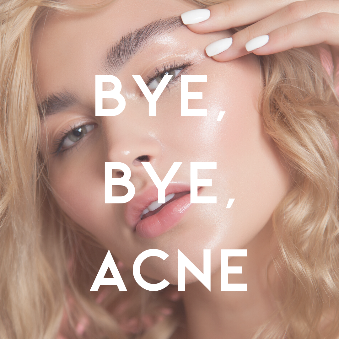 Say Goodbye To Acne
