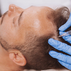 Best PRP for hair growth in Brooklyn, NYC. by licensed providers using only FDA approved products. The goal is to treat and prevent hair loss and thinning hair. CJ Laser is committed to providing the best cosmetic services from lasers to injectables catered to each individual for the most optimal results!